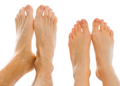 Feet with Bunions