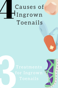 Ingrown toenails infographic