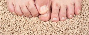 toenail fungus treatment