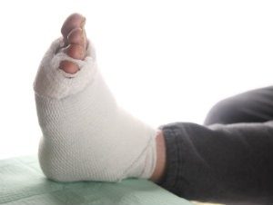 Restoring a foot from charcot