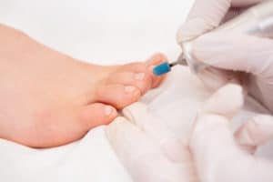 Women are not immune from fungal toenails