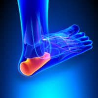 Chronic Heel Pain? How Laser Therapy Could Help