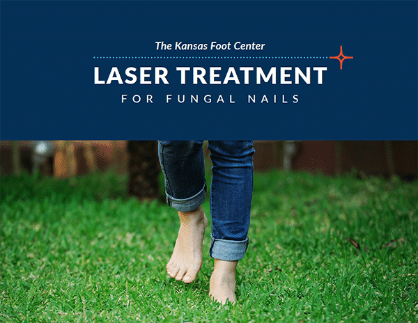 Laser Treatment for Fungals Nails Cover Photo