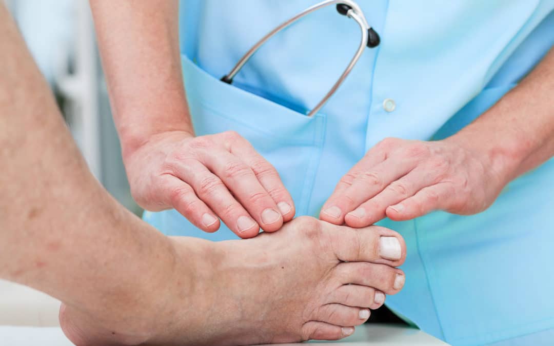 Do You Need Bunion Surgery?