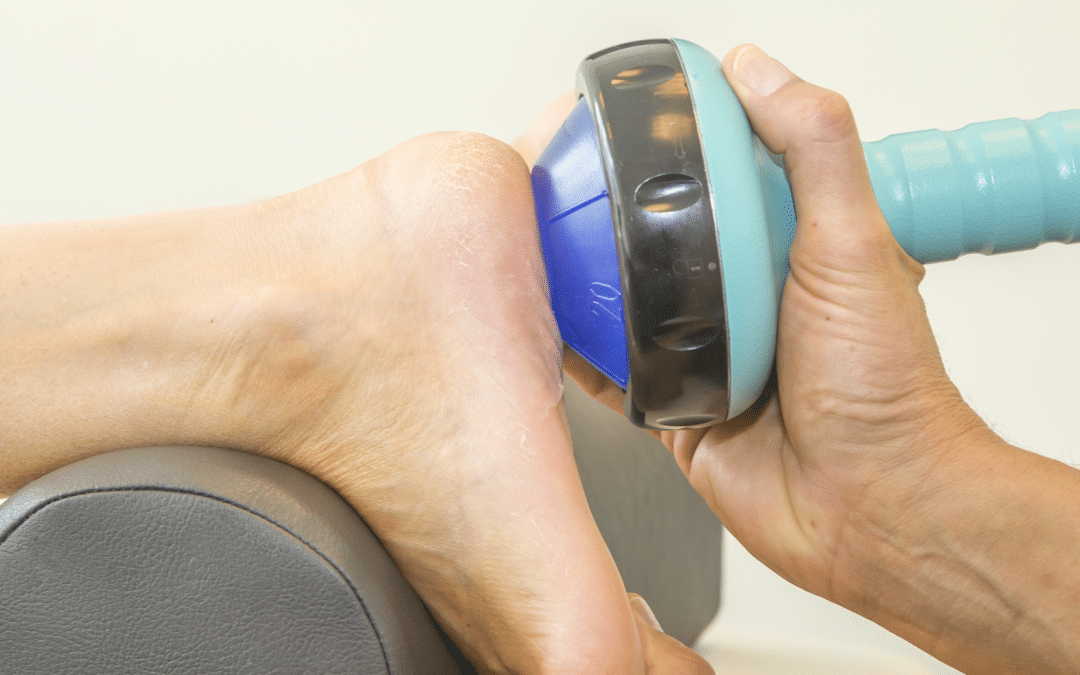 Is Shockwave Therapy an Option for Your Foot Pain?