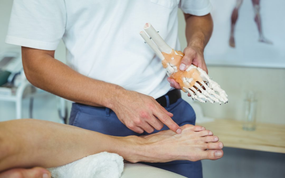 When Are Bunions a Big Concern?